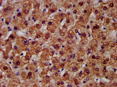 CPS1 Antibody