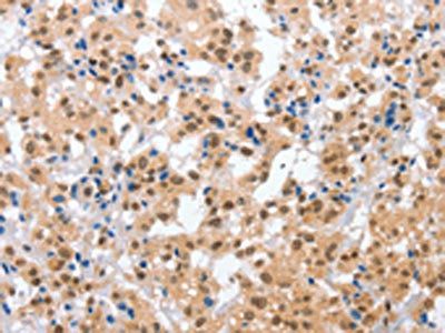 CPSF4 Antibody