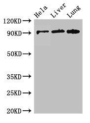 CPT1C Antibody