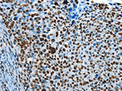 CREB1 Antibody