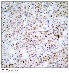 CREB (Phospho-Ser133) Antibody