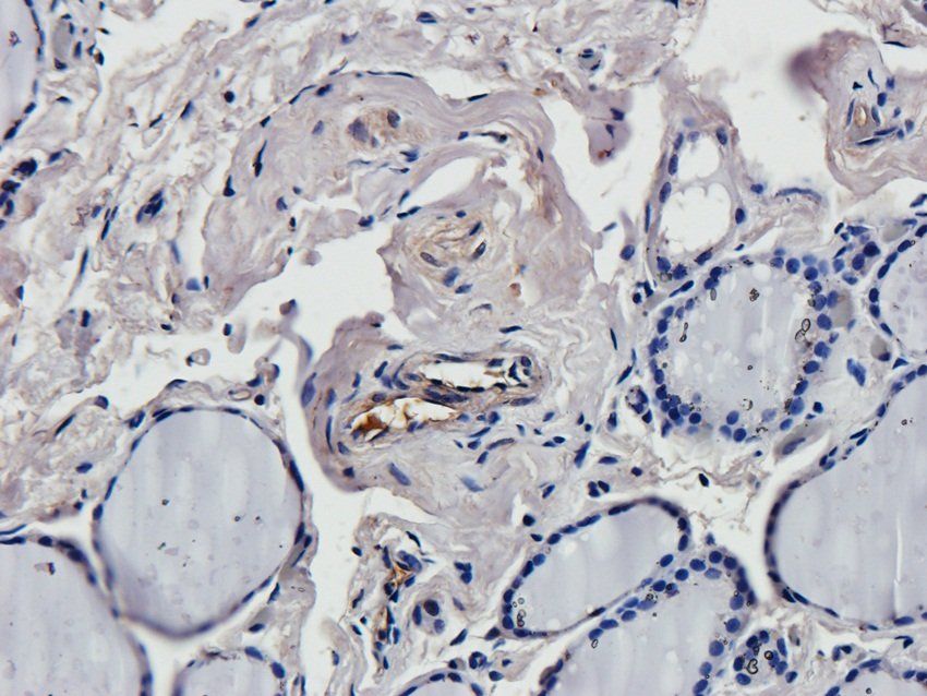 CREB3L3 Rabbit Polyclonal Antibody
