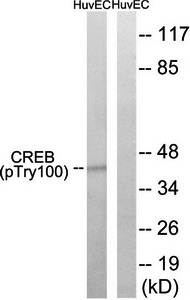 CREB (Phospho-Thr100) Antibody