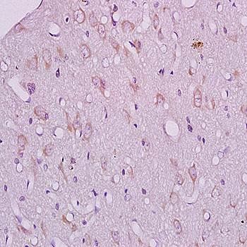 CRHR2 Rabbit Polyclonal Antibody