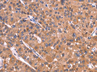CRISP3 Antibody