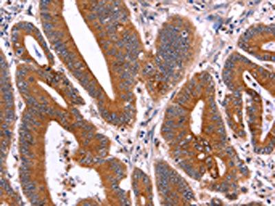 CRISP3 Antibody