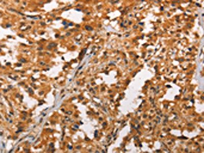 CRKL Antibody