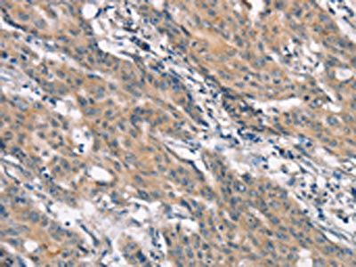 CRKL Antibody