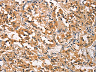 CRKL Antibody