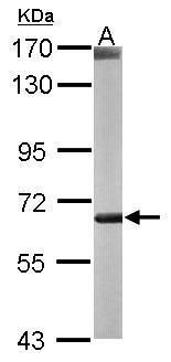 carnitine O-octanoyltransferase Antibody