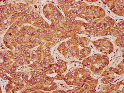 CRTC3 Antibody