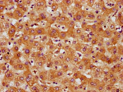 CRTC3 Antibody