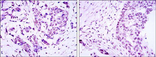 CRTC3 Antibody