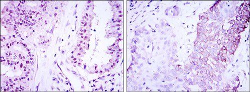 CRTC3 Antibody