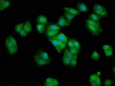 CRYAA Antibody