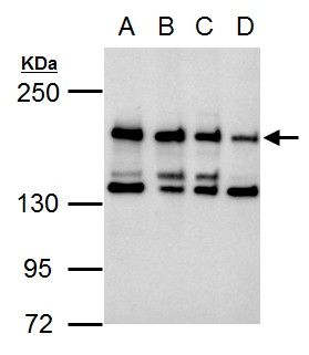 CSB antibody [N2C1], Internal