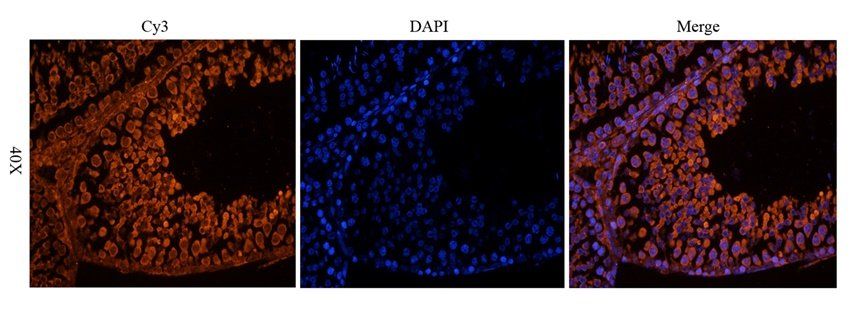 CSEN Rabbit Polyclonal Antibody