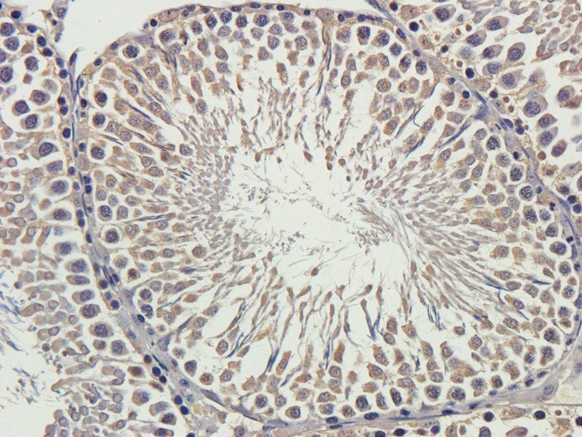 CSEN Rabbit Polyclonal Antibody