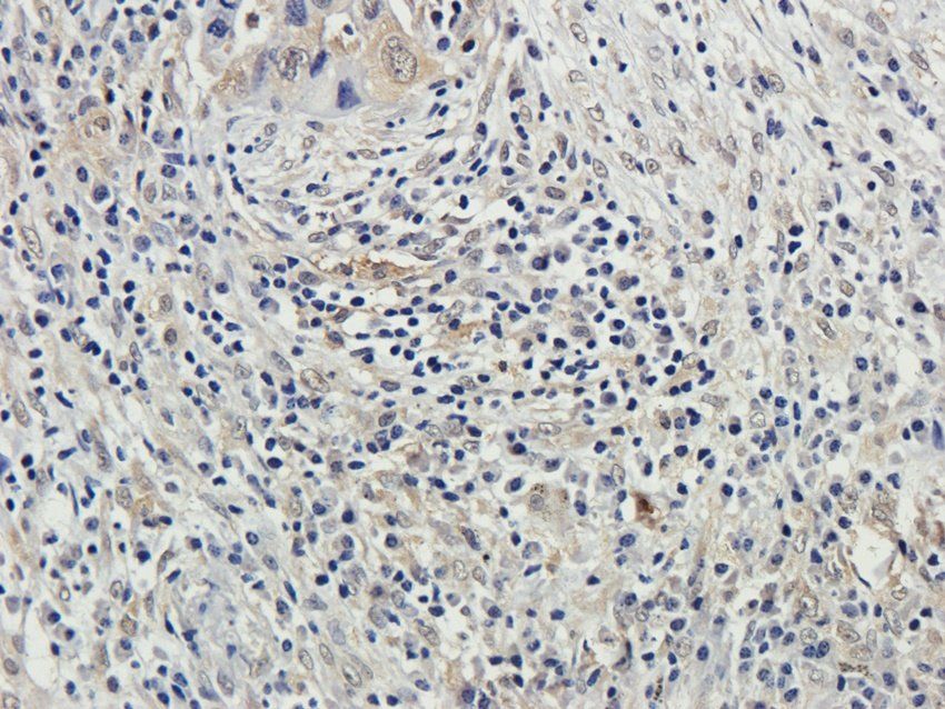 CSEN Rabbit Polyclonal Antibody