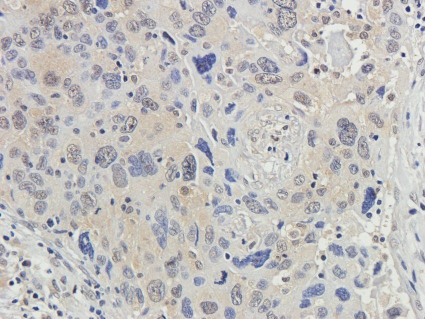 CSEN Rabbit Polyclonal Antibody