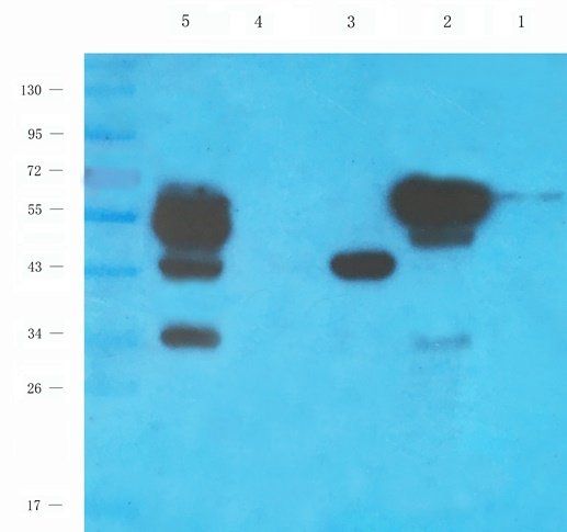 CSEN Rabbit Polyclonal Antibody