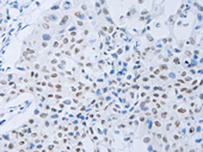 CSF1R Antibody