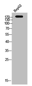 CSF1R Antibody
