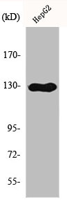CSF2RB Antibody