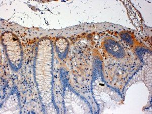 CSK Antibody