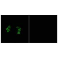 CSNK1A1L/CSNK1A1 Antibody