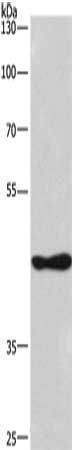 CSNK1D Antibody