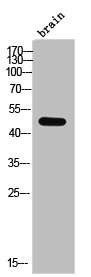 CSNK1D Antibody
