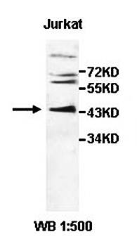CSNK2A1 Rabbit Polyclonal Antibody