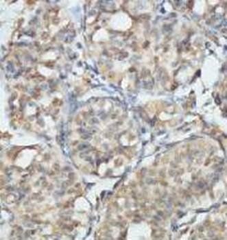 CSNK2A1 Rabbit Polyclonal Antibody