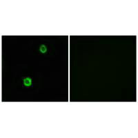 CST1 Antibody