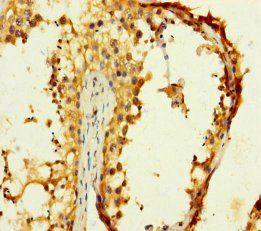 CST11 Antibody