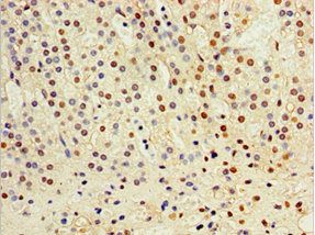CST6 Antibody