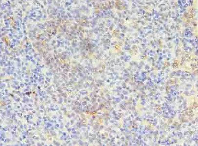 CSTA Antibody