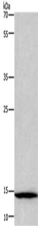 CSTA Antibody