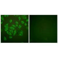 CSTA Antibody