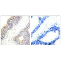 CSTA Antibody