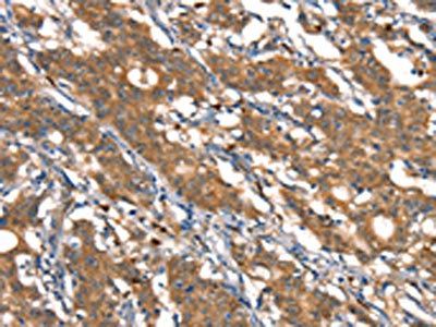 CSTB Antibody