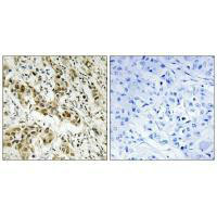 CTBP1 Antibody