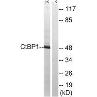 CTBP1 Antibody