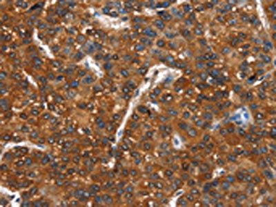 CTBP1 Antibody
