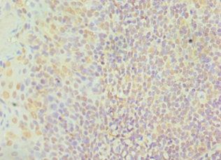 CTCF Antibody