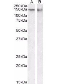 CTCF (isoform 1) Antibody