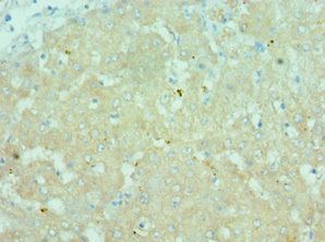 CTCFL Antibody