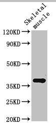 Ctgf Antibody