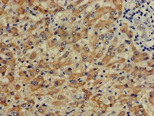 CTH Antibody